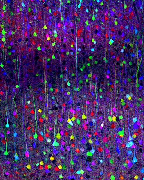 Natural-fractal-stained-neural-connections-synapses-brain.jpg